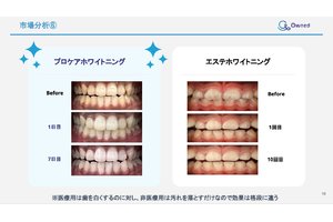 プロケアホワイトニング_item1